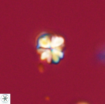 Sphenolithus cf didymikoryfi 64455