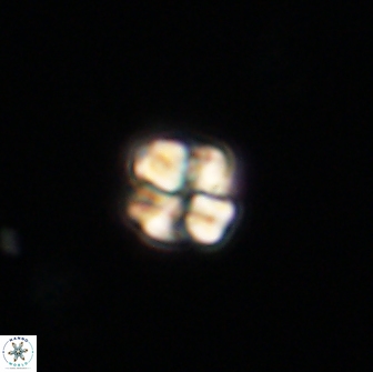 Sphenolithus cf didymikoryfi 64457