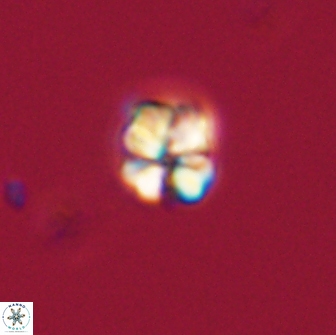 Sphenolithus cf didymikoryfi 64458