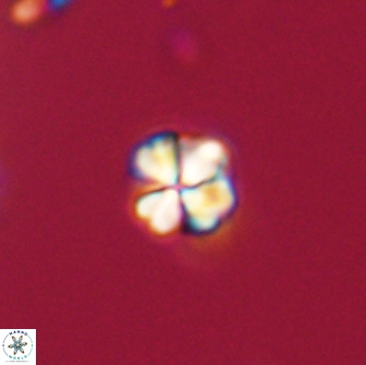 Sphenolithus cf didymikoryfi 64451