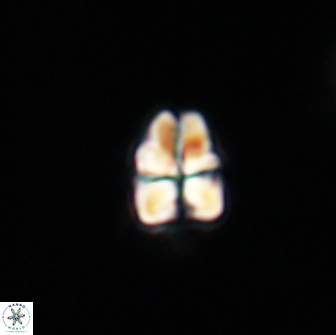 Sphenolithus cf didymikoryfi 64453