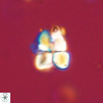 Sphenolithus cf didymikoryfi 69274