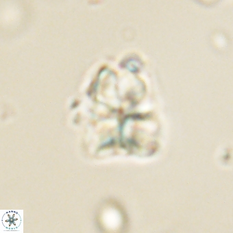 Sphenolithus cf didymikoryfi 69278