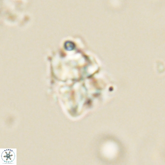 Sphenolithus cf didymikoryfi 69279