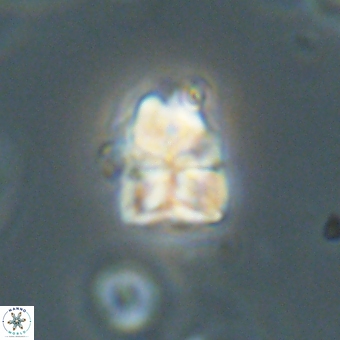 Sphenolithus cf didymikoryfi 69284