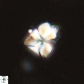 Sphenolithus cf didymikoryfi 69288