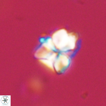 Sphenolithus cf didymikoryfi 69289