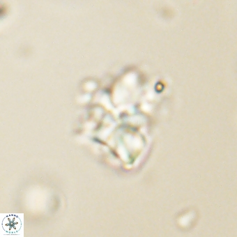 Sphenolithus cf didymikoryfi 69280