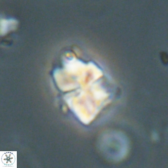 Sphenolithus cf didymikoryfi 69283