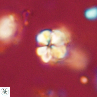 Sphenolithus cf didymikoryfi 69294