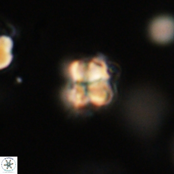 Sphenolithus cf didymikoryfi 69296