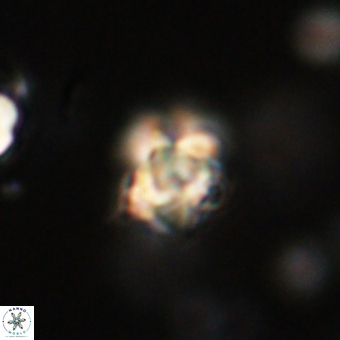 Sphenolithus cf didymikoryfi 69299