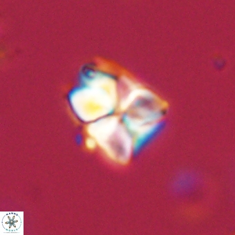 Sphenolithus cf didymikoryfi 69293