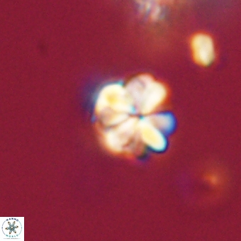 Sphenolithus cf didymikoryfi 69304