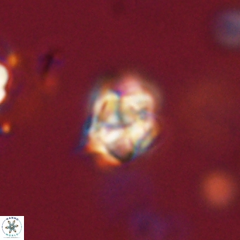 Sphenolithus cf didymikoryfi 69300