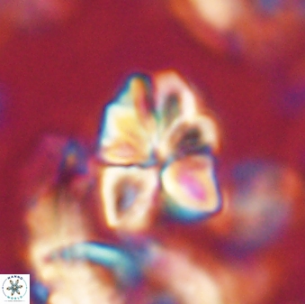 Sphenolithus cf didymikoryfi 62849