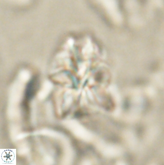 Sphenolithus cf didymikoryfi 62854