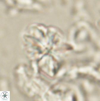 Sphenolithus cf didymikoryfi 62855