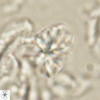 Sphenolithus cf didymikoryfi 62857