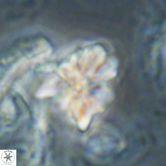 Sphenolithus cf didymikoryfi 62858