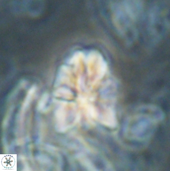Sphenolithus cf didymikoryfi 62859