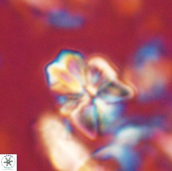 Sphenolithus cf didymikoryfi 62850