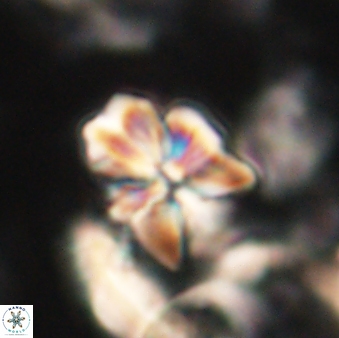 Sphenolithus cf didymikoryfi 62851