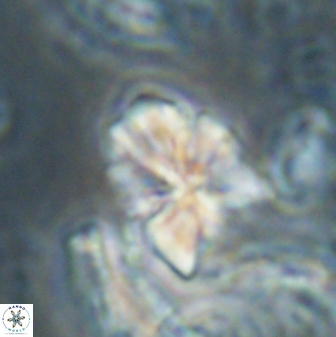 Sphenolithus cf didymikoryfi 62860