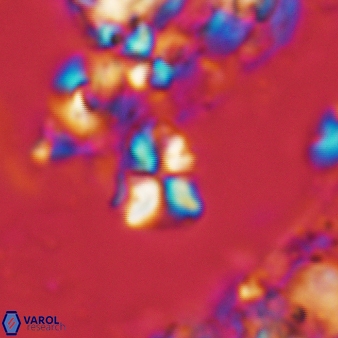 Sphenolithus cf dissimilis 187