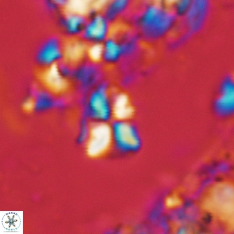 Sphenolithus cf dissimilis 187