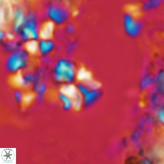 Sphenolithus cf dissimilis 188