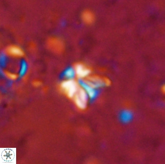 Sphenolithus chamilos 49282