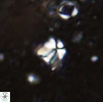 Sphenolithus chamilos 49285