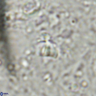 Sphenolithus chamilos 49286