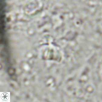 Sphenolithus chamilos 49286