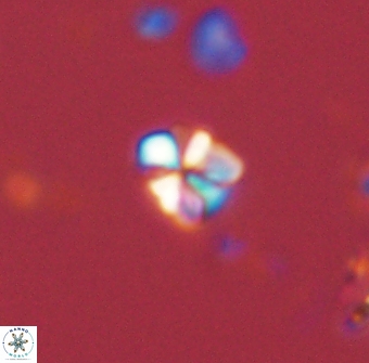 Sphenolithus chamilos 58671