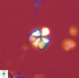 Sphenolithus chamilos 58672