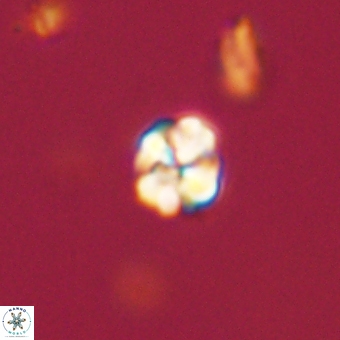 Sphenolithus chamilos 67443