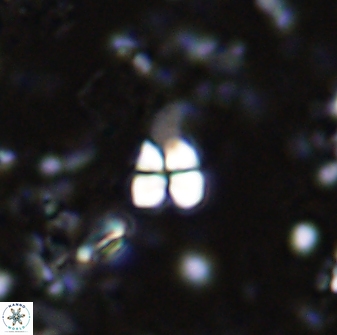 Sphenolithus anarrhopus 42842