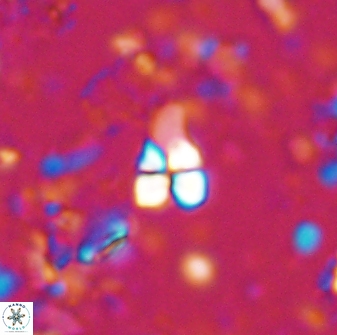 Sphenolithus anarrhopus 42843