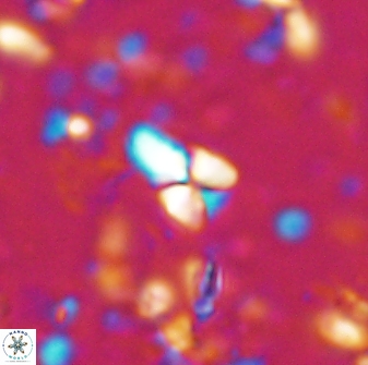 Sphenolithus anarrhopus 42844