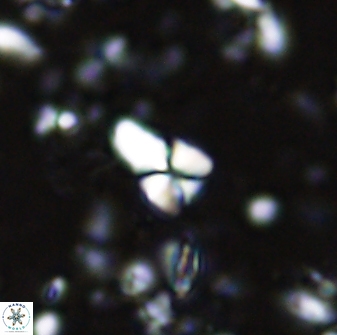 Sphenolithus anarrhopus 42845