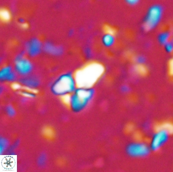 Sphenolithus anarrhopus 42847