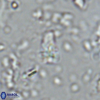 Sphenolithus anarrhopus 42848