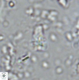 Sphenolithus anarrhopus 42848