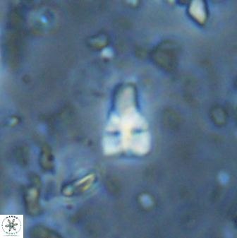Sphenolithus anarrhopus 42849