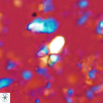 Sphenolithus anarrhopus 43040