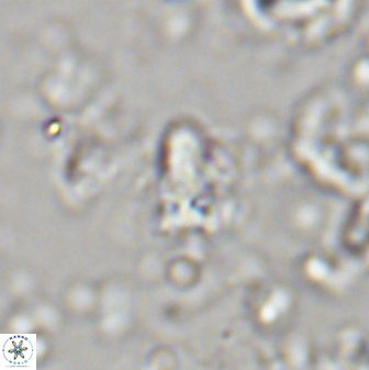 Sphenolithus anarrhopus 43041
