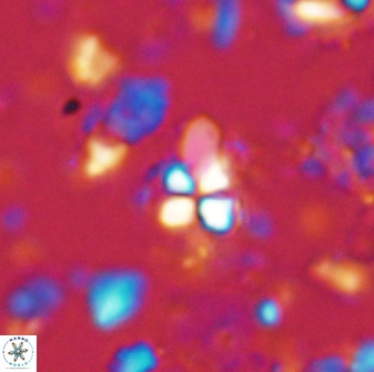 Sphenolithus anarrhopus 43036