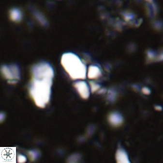 Sphenolithus anarrhopus 43037